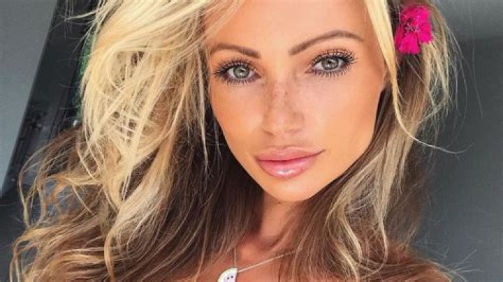 Abby Dowse plastic surgery