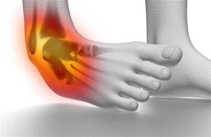 Ankle Sprains | Foot and Ankle Specialists