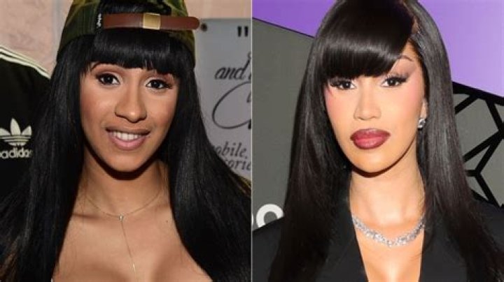 Cardi B got plastic surgery advice from Kim Kardashian