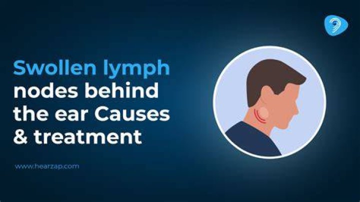 Dealing with Swollen Lymph Nodes Caused by Anxiety