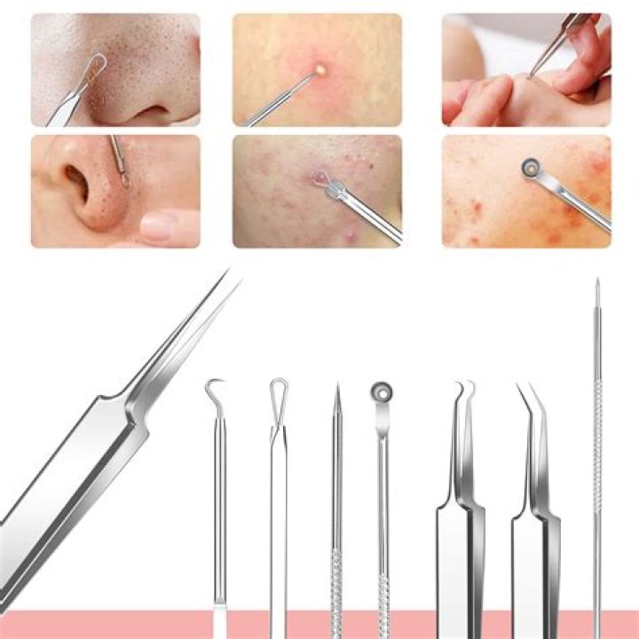 DIY Blackhead Removal Tips That Don't Require Extraction Tools