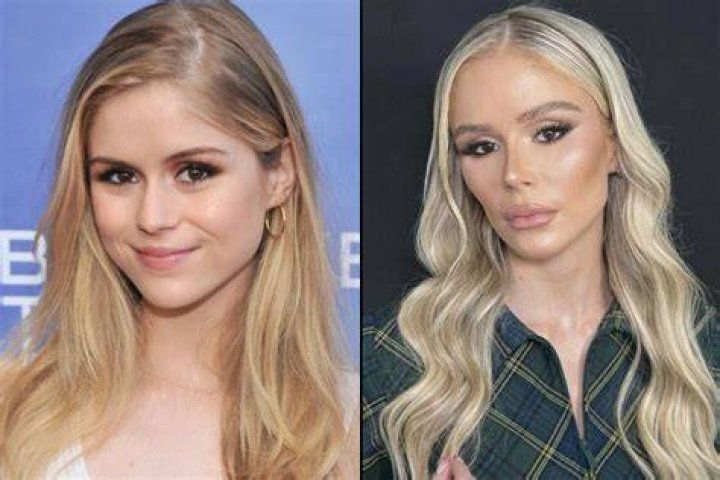 Erin Moriarty plastic surgery Erin Moriarty plastic surgery