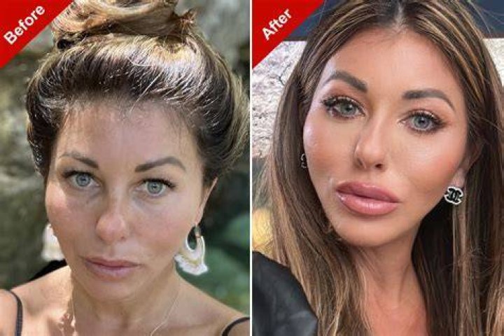 Gloria Plastic Surgery Is The Rumor About Her Plastic Surgery