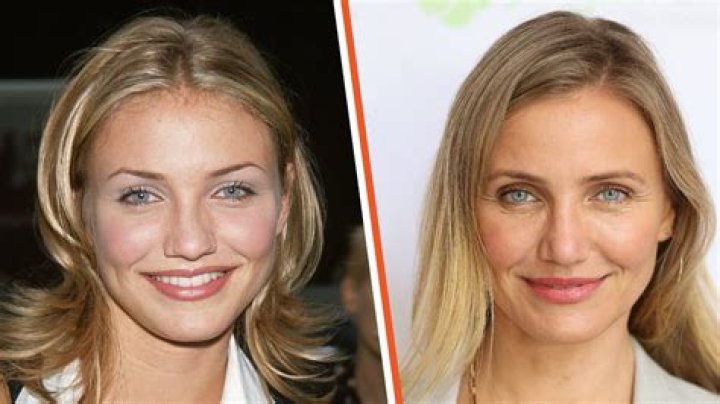 Has Cameron Diaz Had Plastic Surgery? Her Transformation From