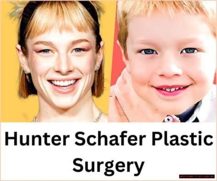 Hunter Schafer Bottom Surgery A Comprehensive Overview
