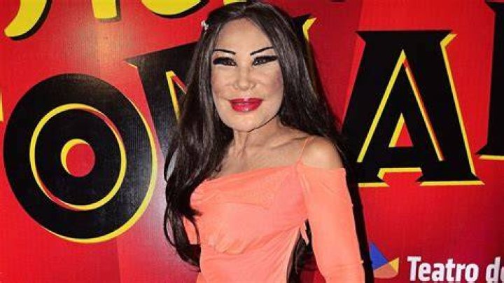 Lyn May tuvo su primera cirug&iacute;a a esta edad y as&iacute; luc&iacute;a cuando estaba natural MDZ Online