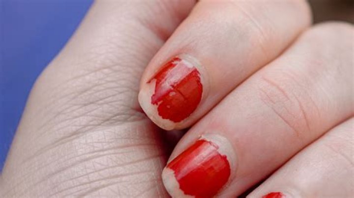 Nail Polish Chipping