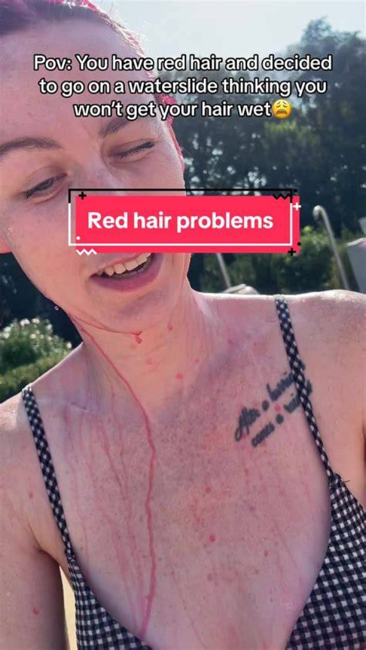 red hair problems