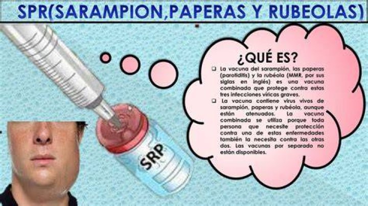 Spr Y Bruno.png