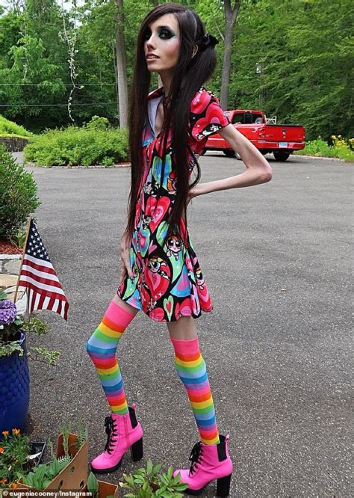 The Post Calls Model Codie Young Anorexic, Codie Responds