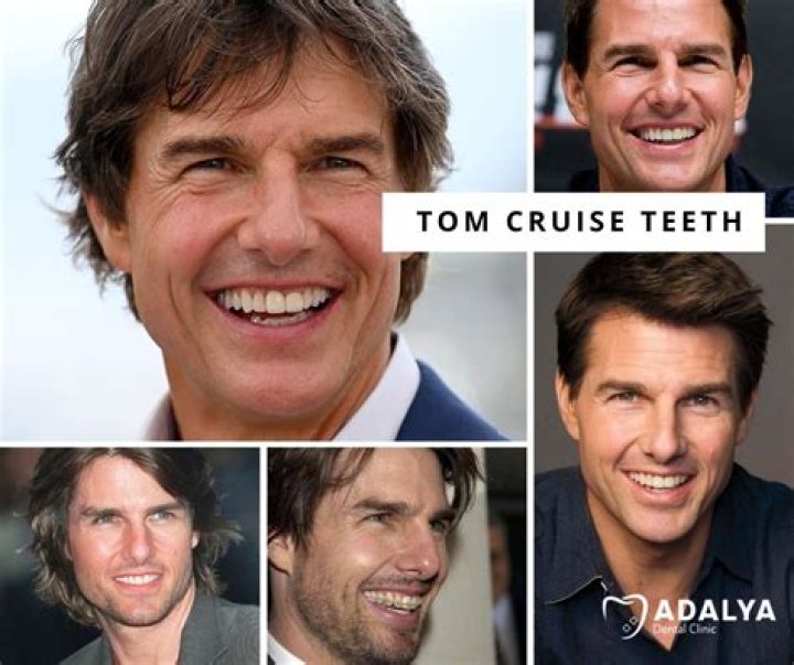 Tom Cruise Teeth Before And After Smile Makeover 1 Cristiano Ronaldo