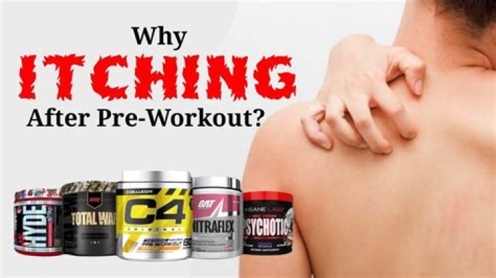 Why Does Pre Workout Make Me Itchy