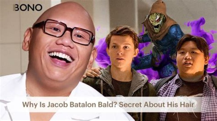 Why Is Jacob Batalon Bald Digital Global Times